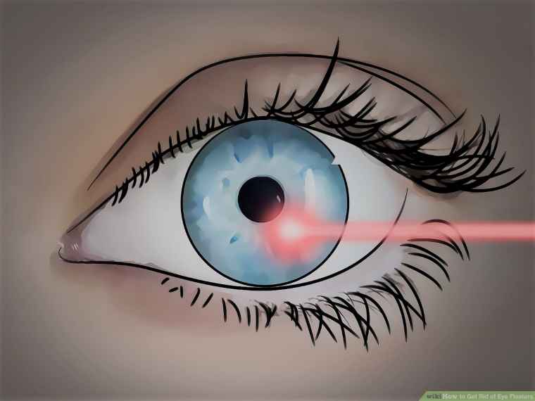What Are The Eye Floaters How You Can Get Rid of it